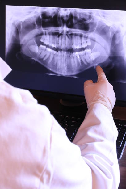 Best Root Canal Emergency Dentist  in Colfax, LA