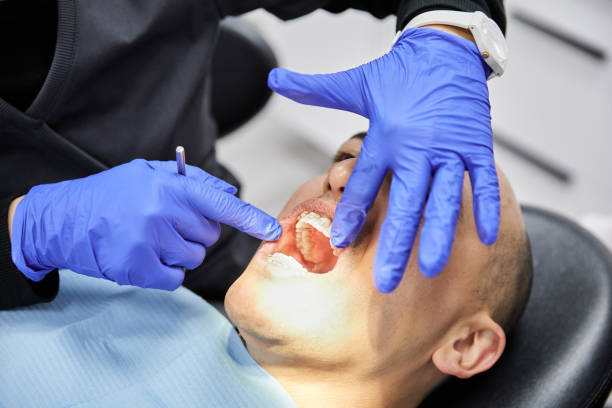 Best Emergency Tooth Extraction  in Colfax, LA